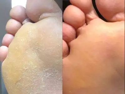 no-allow