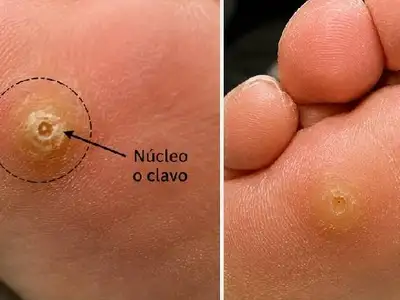 no-allow
