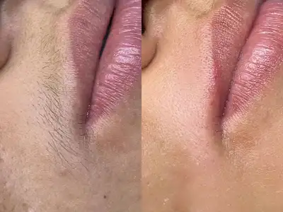 no-allow