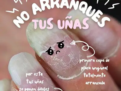 no-allow