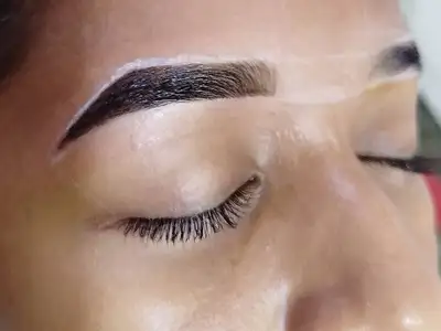 no-allow